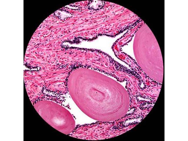 40X-400X Cordless LED Compound Microscope N1777